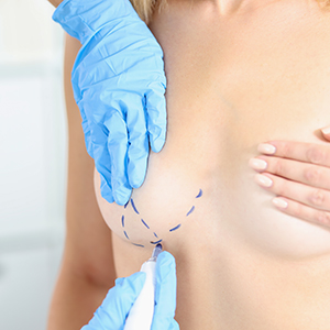 Doctor draws marks on female breast